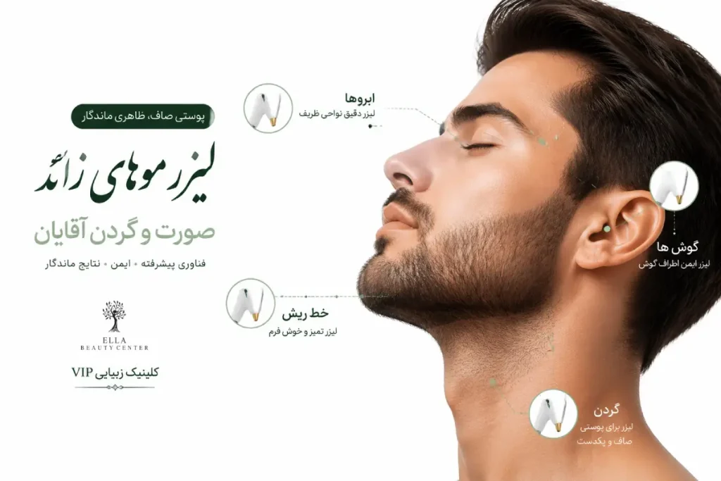 لیزر صورت و گردن آقایان