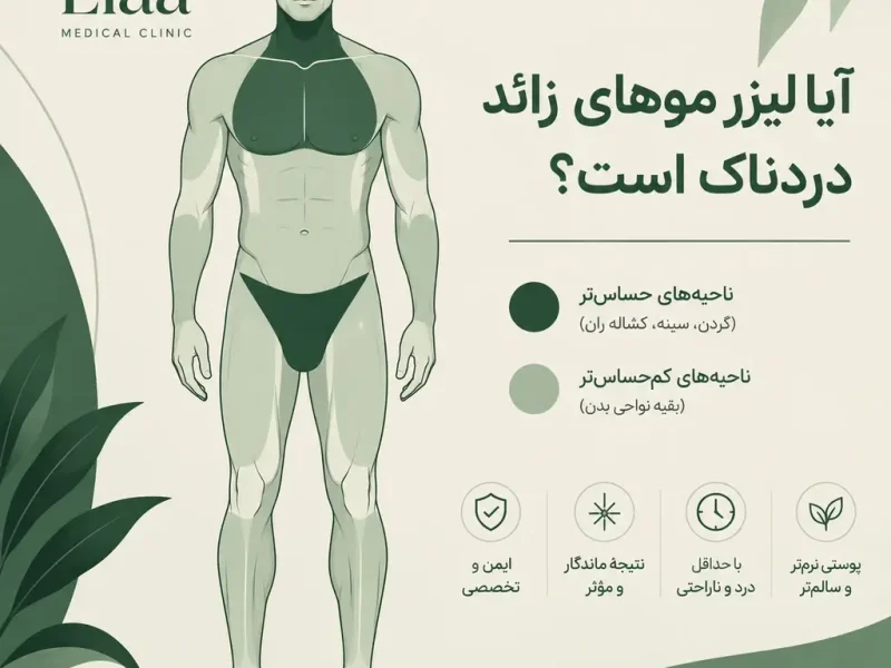 آیا لیزر موهای زائد دردناک است؟