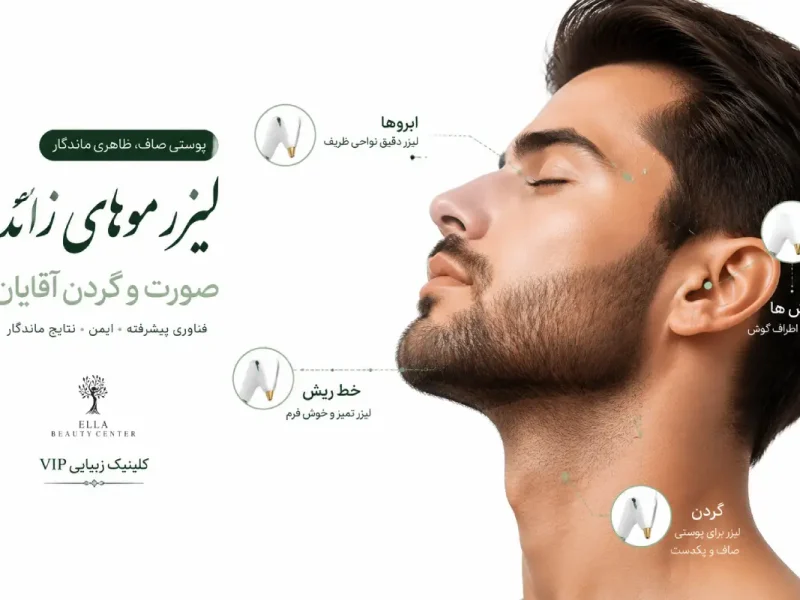 لیزر صورت و گردن آقایان