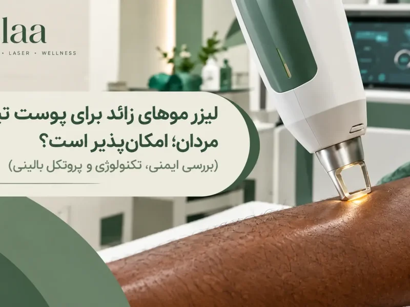 لیزر موهای زائد برای پوست تیره مردان؛ امکان_پذیر است؟ (بررسی ایمنی، تکنولوژی و پروتکل بالینی)